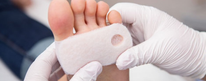 Diabetic Foot