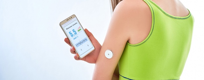 Continuous Glucose Monitoring